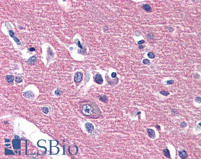 Anti-CADM2 antibody LS-A9921 IHC of human brain, cortex. Immunohistochemistry of formalin-fixed, paraffin-embedded tissue after heat-induced antigen retrieval.