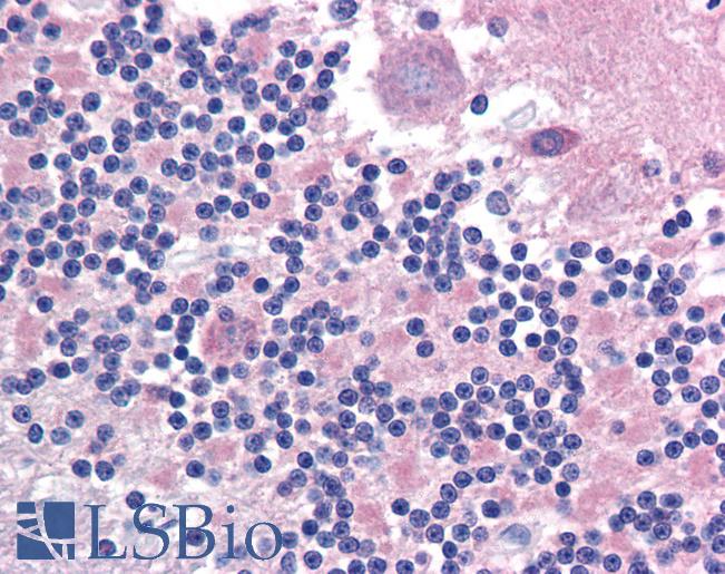 Anti-CADM2 antibody LS-A9921 IHC of human brain, cerebellum. Immunohistochemistry of formalin-fixed, paraffin-embedded tissue after heat-induced antigen retrieval.