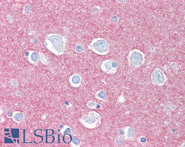 Anti-CADM2 antibody IHC of human brain neuropil. Immunohistochemistry of formalin-fixed, paraffin-embedded tissue after heat-induced antigen retrieval.