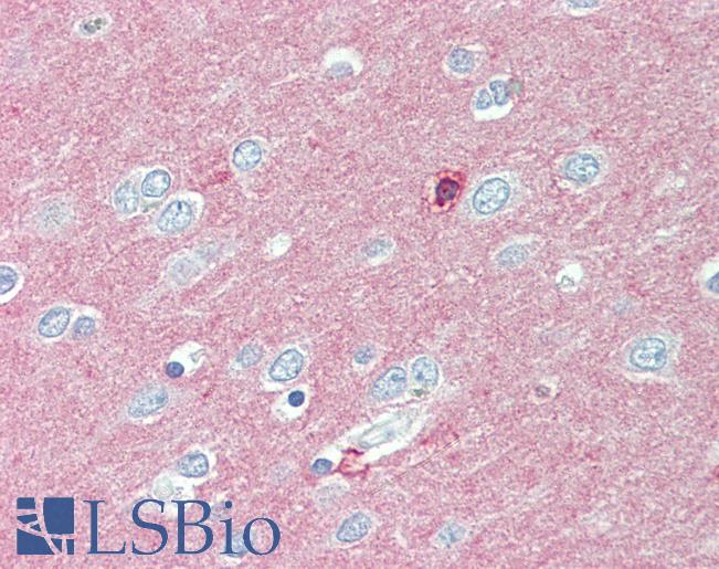 Anti-CADM2 antibody LS-A9291 IHC of human brain, cortex. Immunohistochemistry of formalin-fixed, paraffin-embedded tissue after heat-induced antigen retrieval.