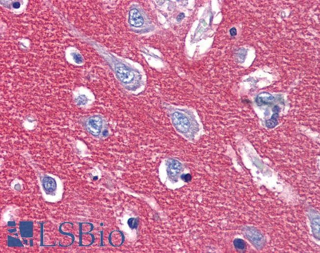 Anti-CADM2 antibody LS-A9923 IHC of human brain, cortex. Immunohistochemistry of formalin-fixed, paraffin-embedded tissue after heat-induced antigen retrieval.