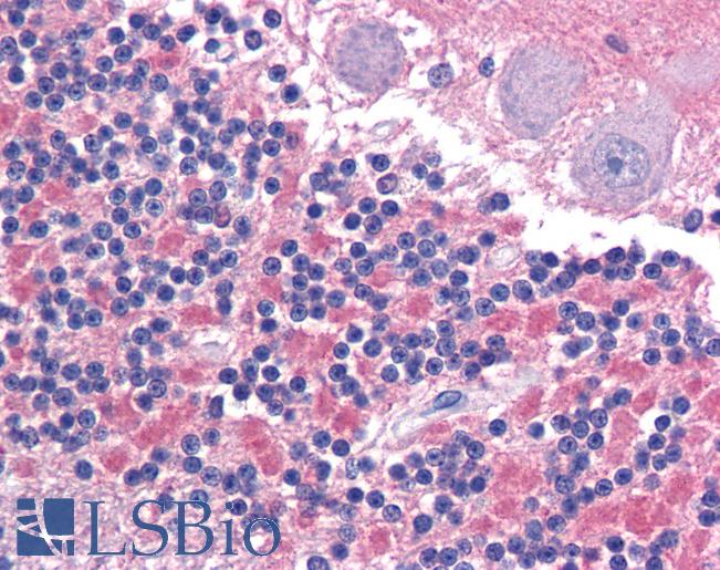 Anti-CADM2 antibody LS-A9923 IHC of human brain, cerebellum. Immunohistochemistry of formalin-fixed, paraffin-embedded tissue after heat-induced antigen retrieval.