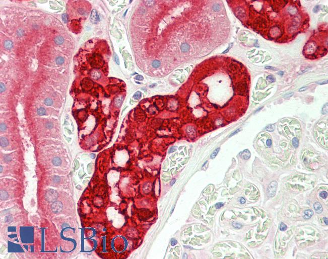Anti-CALB1 / Calbindin antibody IHC staining of human kidney. Immunohistochemistry of formalin-fixed, paraffin-embedded tissue after heat-induced antigen retrieval. Antibody LS-B11187 concentration 5 ug/ml.