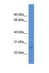 CALB1 / Calbindin antibody LS-C135713 Western blot of COL0205 Cell lysate. Antibody concentration 1 ug/ml.