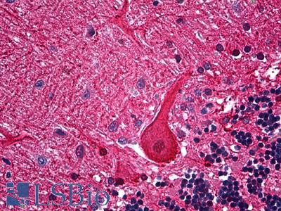 Anti-CALB1 / Calbindin antibody IHC of human brain, cerebellum. Immunohistochemistry of formalin-fixed, paraffin-embedded tissue after heat-induced antigen retrieval. Antibody LS-B5186 dilution 1:100.