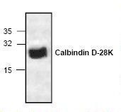 Western blot of Calbindin antibody LS-C146986.