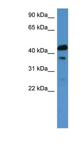 CALCR / Calcitonin Receptor antibody LS-C135572 Western blot of Fetal Kidney lysate.