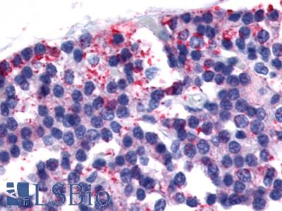 Anti-Calcitonin Receptor antibody LS-A769 IHC of human parathyroid. Immunohistochemistry of formalin-fixed, paraffin-embedded tissue after heat-induced antigen retrieval.