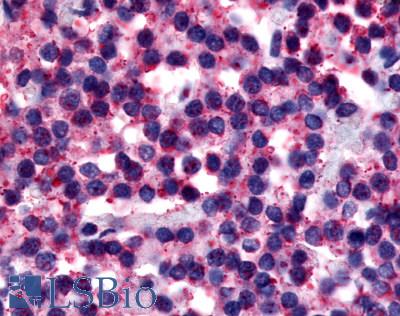 Anti-Calcitonin Receptor antibody LS-A766 IHC of human parathyroid. Immunohistochemistry of formalin-fixed, paraffin-embedded tissue after heat-induced antigen retrieval.