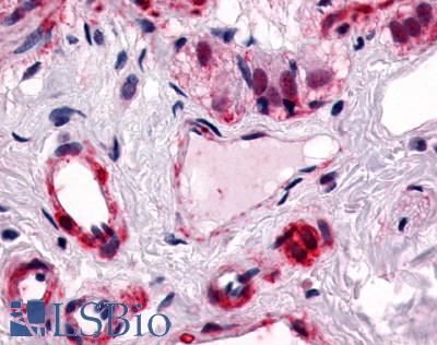 Anti-CALCRL antibody LS-A6731 IHC of human colon, submucosal plexus and submucosal vessels. Immunohistochemistry of formalin-fixed, paraffin-embedded tissue after heat-induced antigen retrieval.