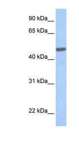 CALCRL antibody LS-C101953 Western blot of Fetal Muscle lysate.