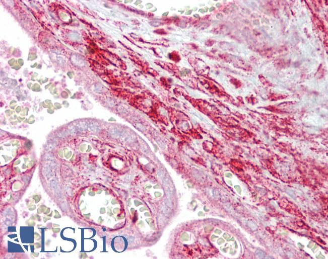 Anti-CALD1 / Caldesmon antibody IHC of human placenta. Immunohistochemistry of formalin-fixed, paraffin-embedded tissue after heat-induced antigen retrieval. Antibody LS-B6829 concentration 5 ug/ml.