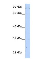 293T cell lysate. Antibody concentration: 1.0 ug/ml. Gel concentration: 12%.