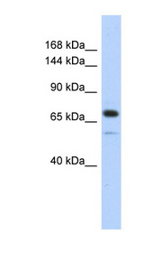 CALD1 / Caldesmon antibody LS-C110713 Western blot of Transfected 293T cell lysate.