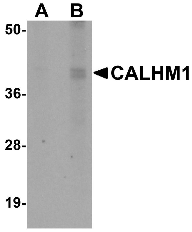 Western blot analysis of CALHM1 in rat liver tissue lysate with CALHM1 antibody at (A) 1 and (B) 2 ug/ml.