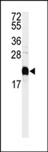 Western blot of anti-Calmodulin Antibody in HeLa cell line lysates (35 ug/lane). Calmodulin(arrow) was detected using the purified antibody.