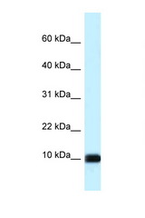 CALML3 antibody LS-C145683 Western blot of HeLa Cell lysate. Antibody concentration 1 ug/ml.