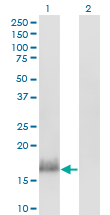 Western blot of CALML3 expression in transfected 293T cell line by CALML3 monoclonal antibody (M04), clone 2A11.