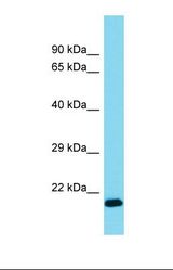 Western blot of Mouse Pancreas. Calml4 antibody dilution 1.0 ug/ml.