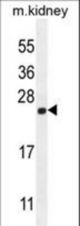 CALML4 Antibody western blot of mouse kidney tissue lysates (35 ug/lane). The CALML4 antibody detected the CALML4 protein (arrow).