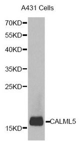 Western blot analysis of extracts of A431 cell line, using CALML5 antibody.