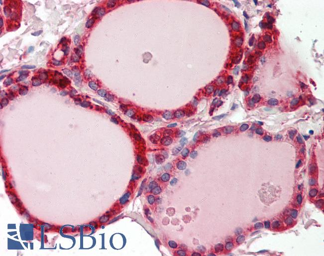 Human Thyroid: Formalin-Fixed, Paraffin-Embedded (FFPE)