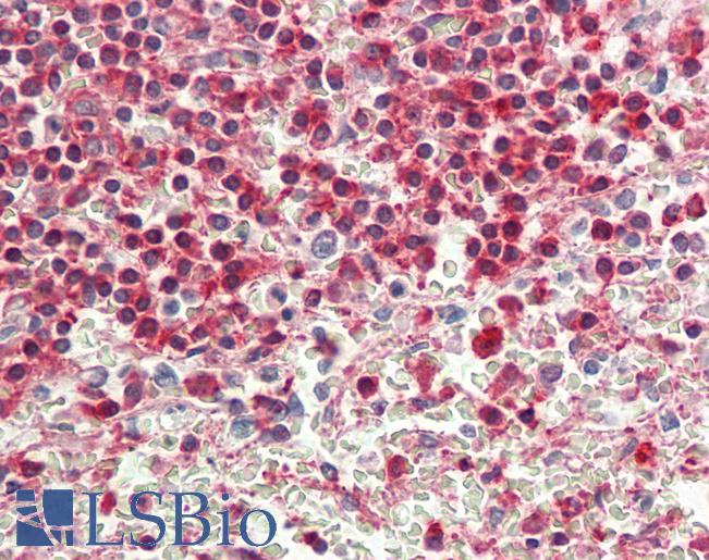 Anti-ACTG1 / Gamma Actin antibody IHC staining of human spleen. Immunohistochemistry of formalin-fixed, paraffin-embedded tissue after heat-induced antigen retrieval.