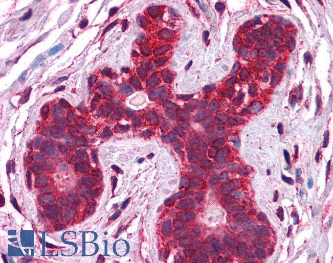 Anti-Calreticulin antibody IHC of human breast. Immunohistochemistry of formalin-fixed, paraffin-embedded tissue after heat-induced antigen retrieval. Antibody LS-B5578 concentration 5 ug/ml.