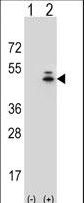 Western blot of ACTG1 (arrow) using rabbit polyclonal ACTG1 Antibody. 293 cell lysates (2 ug/lane) either nontransfected (Lane 1) or transiently transfected (Lane 2) with the ACTG1 gene.