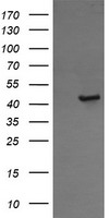 HEK293T cells were transfected with the pCMV6-ENTRY control (Left lane) or pCMV6-ENTRY CALR3 (Right lane) cDNA for 48 hrs and lysed. Equivalent amounts of cell lysates (5 ug per lane) were separated by SDS-PAGE and immunoblotted with anti-CALR3.