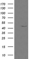 HEK293T cells were transfected with the pCMV6-ENTRY control (Left lane) or pCMV6-ENTRY CALR3 (Right lane) cDNA for 48 hrs and lysed. Equivalent amounts of cell lysates (5 ug per lane) were separated by SDS-PAGE and immunoblotted with anti-CALR3.