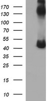 HEK293T cells were transfected with the pCMV6-ENTRY control (Left lane) or pCMV6-ENTRY CALR3 (Right lane) cDNA for 48 hrs and lysed. Equivalent amounts of cell lysates (5 ug per lane) were separated by SDS-PAGE and immunoblotted with anti-CALR3.