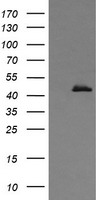 HEK293T cells were transfected with the pCMV6-ENTRY control (Left lane) or pCMV6-ENTRY CALR3 (Right lane) cDNA for 48 hrs and lysed. Equivalent amounts of cell lysates (5 ug per lane) were separated by SDS-PAGE and immunoblotted with anti-CALR3.
