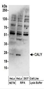 Detection of Human CALY by Western Blot. Samples: Whole cell lysate (50 ug) prepared using NETN and RIPA buffer from HeLa and 293T cells. Antibodies: Affinity purified rabbit anti-CALY antibody used for WB at 0.4 ug/ml. Detection: Chemiluminescence with an exposure time of 3 minutes.
