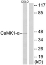 Western blot of extracts from COLO cells, using CaMK1-alpha (Ab-177) Antibody. The lane on the right is treated with the synthesized peptide.