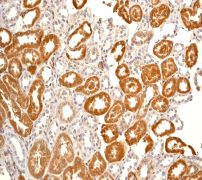 IHC of paraffin-embedded human kidney using anti-CaMK1 antibody (LS-C105301).