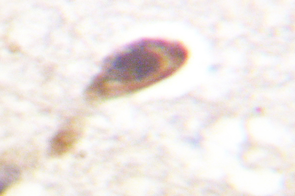 IHC of CaMK4 (V192/196) pAb in paraffin-embedded human breast tissue.