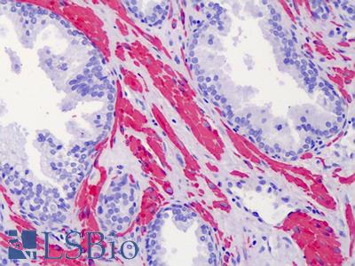 Anti-ACTG2 / Gamma-2 Actin antibody IHC of human prostate. Immunohistochemistry of formalin-fixed, paraffin-embedded tissue after heat-induced antigen retrieval. Antibody LS-B4901 concentration 5 ug/ml.