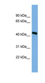 CAMK1D antibody LS-C116675 Western blot of HepG2 cell lysate.