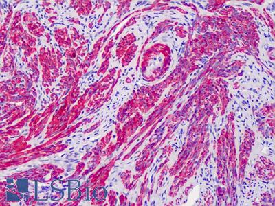 Anti-ACTG2 / Gamma-2 Actin antibody IHC of human uterus. Immunohistochemistry of formalin-fixed, paraffin-embedded tissue after heat-induced antigen retrieval. Antibody LS-B4901 concentration 5 ug/ml.