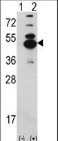 Western blot of CAMK1D (arrow) using rabbit polyclonal CAMK1D Antibody. 293 cell lysates (2 ug/lane) either nontransfected (Lane 1) or transiently transfected with the CAMK1D gene (Lane 2).