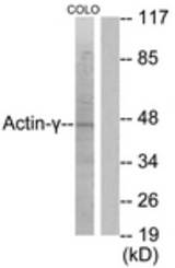 Western blot of extracts from COLO205 cells, using Actin-gamma2 Antibody. The lane on the right is treated with the synthesized peptide.