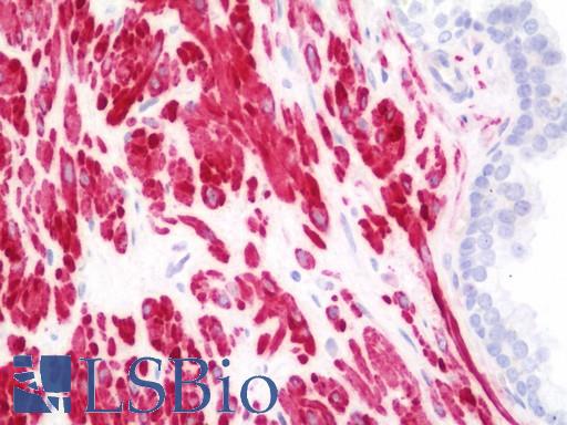 Anti-ACTG2 antibody IHC staining of human prostate. Immunohistochemistry of formalin-fixed, paraffin-embedded tissue after heat-induced antigen retrieval. Antibody LS-B11114 dilution 1:100.
