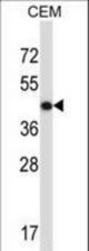 ACTG2 Antibody western blot of CEM cell line lysates (35 ug/lane). The ACTG2 antibody detected the ACTG2 protein (arrow).