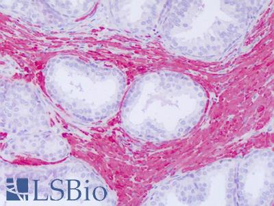 Anti-ACTG2 antibody IHC of human prostate. Immunohistochemistry of formalin-fixed, paraffin-embedded tissue after heat-induced antigen retrieval. Antibody LS-B8283 dilution 5-10 ug/ml.