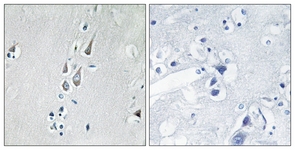 Immunohistochemistry analysis of paraffin-embedded human brain, using CaMK2 (Phospho-Thr286) Antibody. The picture on the right is treated with the synthesized peptide.