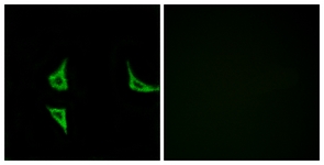Immunofluorescence analysis of COS7 cells, using CaMK2 (Phospho-Thr286) Antibody. The picture on the right is treated with the synthesized peptide.