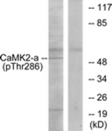 Western blot analysis of extracts from K562 cells, using CaMK2 (Phospho-Thr286) Antibody. The lane on the right is treated with the synthesized peptide.