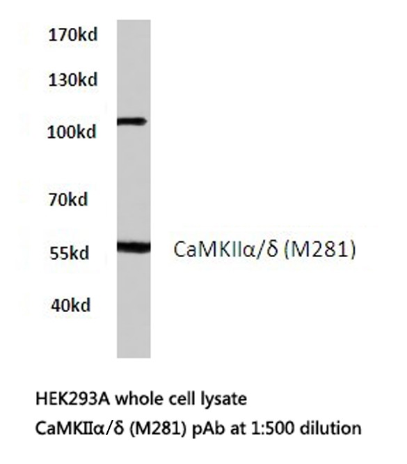 Western blot of CaMKII/ (M281)pAb in extracts from HEK293A cells.