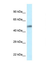 CAMK2D antibody LS-C145626 Western blot of HT1080 Cell lysate. Antibody concentration 1 ug/ml.
